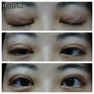口コミ