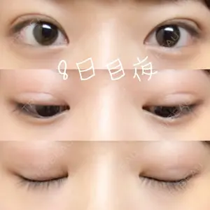 口コミ