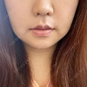 湘南美容クリニック 湘南美容クリニック 新宿本院口コミ
