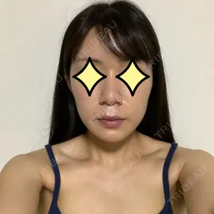 湘南美容クリニック 湘南美容クリニック 名古屋栄院口コミ