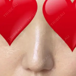 リッツ美容外科 大阪院口コミ