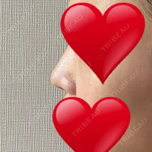 リッツ美容外科 大阪院口コミ