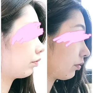 HANABI整形外科口コミ