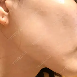 湘南美容クリニック 湘南美容クリニック 柏院口コミ