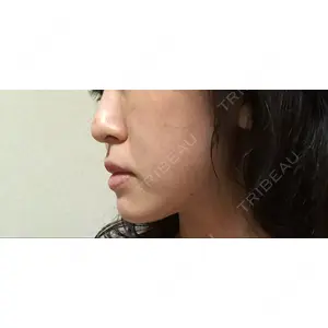 口コミ