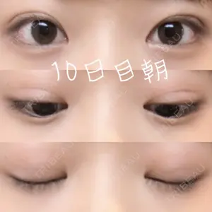 口コミ