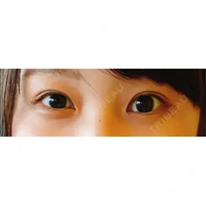 湘南美容クリニック 湘南美容クリニック 赤坂見附院口コミ