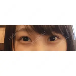 湘南美容クリニック 湘南美容クリニック 赤坂見附院口コミ