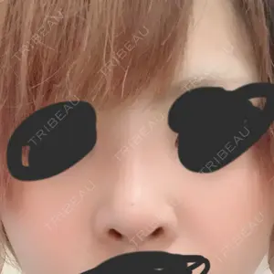 リッツ美容外科 大阪院口コミ