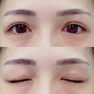 A CLINIC（エークリニック） A CLINIC（エークリニック） 銀座院口コミ