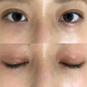 A CLINIC（エークリニック） A CLINIC（エークリニック） 銀座院口コミ