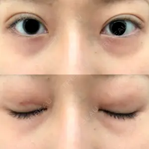 A CLINIC（エークリニック） A CLINIC（エークリニック） 銀座院口コミ