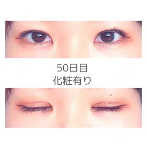 口コミ
