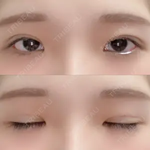 湘南美容クリニック 湘南美容クリニック 赤坂見附院口コミ