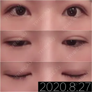口コミ