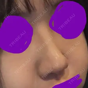 マーブル整形外科口コミ