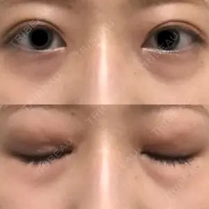 A CLINIC（エークリニック） A CLINIC（エークリニック） 銀座院口コミ