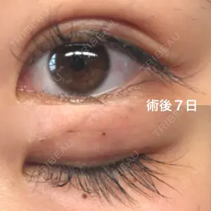 湘南美容クリニック 湘南美容クリニック 京都院口コミ