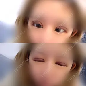 口コミ