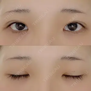 湘南美容クリニック 湘南美容クリニック 赤坂見附院口コミ