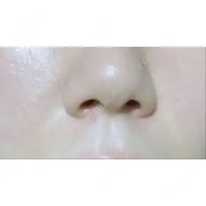 湘南美容クリニック 湘南美容クリニック 名古屋栄院口コミ