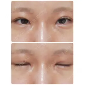 聖心美容クリニック グループ 聖心美容クリニック 六本木院口コミ