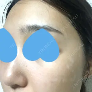南青山TOKUNAKAクリニック口コミ