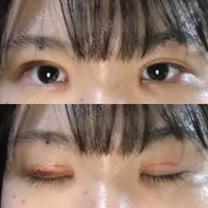 TCB東京中央美容外科 TCB東京中央美容外科 中野院口コミ
