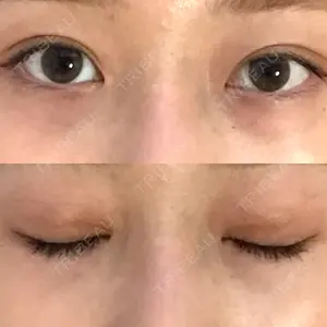 A CLINIC（エークリニック） A CLINIC（エークリニック） 銀座院口コミ