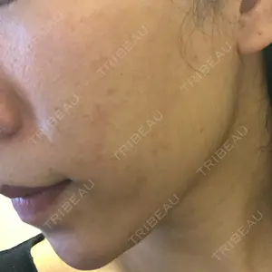 南青山TOKUNAKAクリニック口コミ