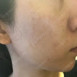 南青山TOKUNAKAクリニック口コミ