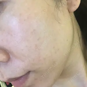 南青山TOKUNAKAクリニック口コミ