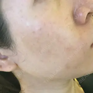 南青山TOKUNAKAクリニック口コミ