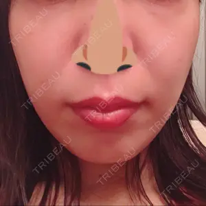 SUEクリニック口コミ