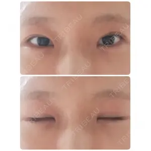 聖心美容クリニック グループ 聖心美容クリニック 六本木院口コミ