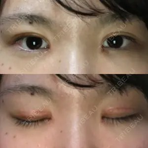 TCB東京中央美容外科 TCB東京中央美容外科 中野院口コミ