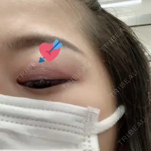口コミ