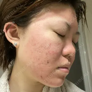 VENUS BEAUTY CLINIC　銀座院口コミ