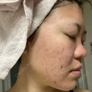 VENUS BEAUTY CLINIC　銀座院口コミ