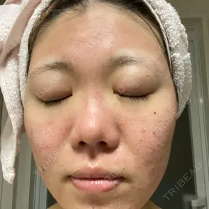 VENUS BEAUTY CLINIC　銀座院口コミ
