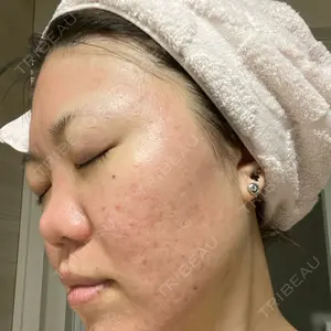 VENUS BEAUTY CLINIC　銀座院口コミ