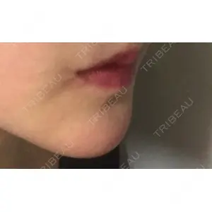 現代美学整形外科口コミ