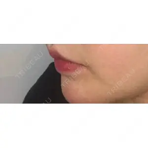 現代美学整形外科口コミ