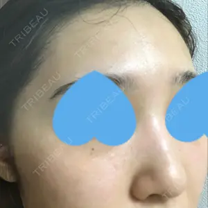 南青山TOKUNAKAクリニック口コミ