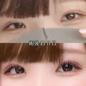 湘南美容クリニック 湘南美容クリニック 赤坂見附院口コミ