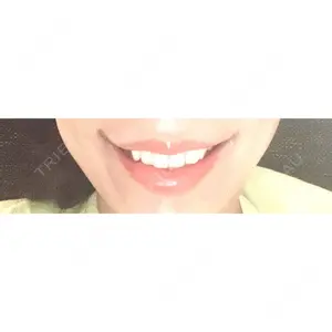 口コミ