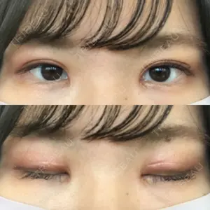 TCB東京中央美容外科 TCB東京中央美容外科 中野院口コミ