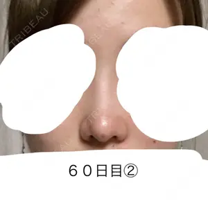 HANABI整形外科口コミ