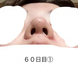 HANABI整形外科口コミ