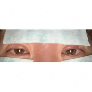 湘南美容クリニック 湘南美容クリニック 宇都宮院口コミ